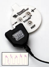 EMG Myoscan -Pro 60 Hz V2 Sensor