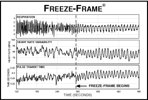 Freeze-Framer graph showing heart rate variability, respirationl, and pulse transit time