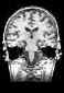 brainimageBW.jpg (9111 bytes)